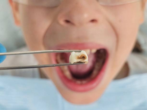 Best Dentist for Tooth Abscess  in Altoona, PA